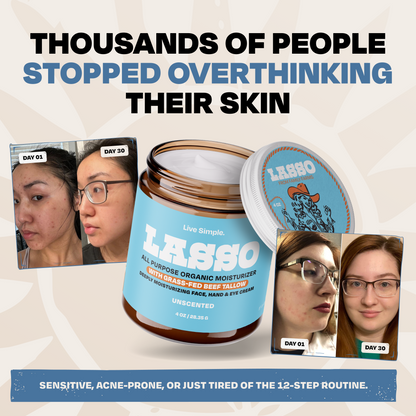 The Complete LASSO Kit