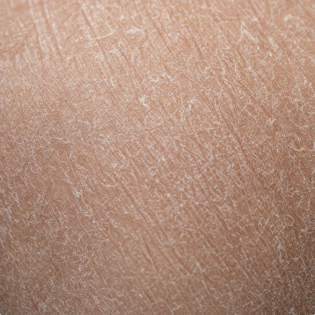 Dry, Irritated, Itchy Skin